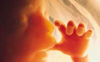 Ребенку 4 года, сосет палец. как отучить?