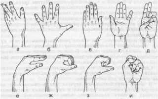 Что делать, когда не разгибается палец на руке