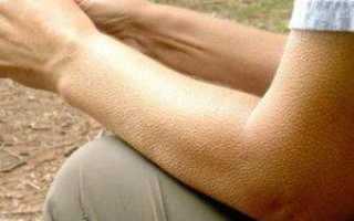 Почему случается и насколько опасно покалывание в пальцах левой руки