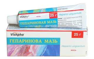 Флебит вены на руке