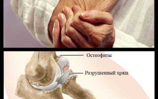 Боль в бицепсе левой руки