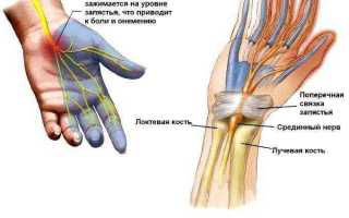 Причины, по которым немеют руки по ночам. полный обзор заболеваний