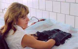 Почему срастаются пальцы на ноге? сросшиеся пальцы на ногах у новорожденного: возможные причины