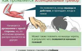 Как избавиться от тремора? что делать, если трясутся руки?