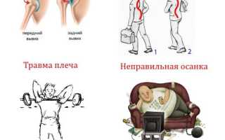 Почему болит плечо при отведении руки назад?