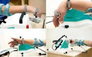 Хирургия кисти в израиле