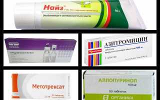 Панариций (паронихия)