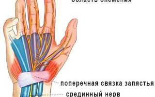 Рука онемела и не проходит: что делать