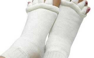 Искривление пальцев на ногах: причины, методы лечения. операция на стопе