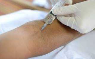 Как выглядит тромб на руке симптомы фото