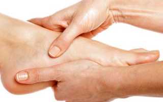 Шпоры на ногах: симптомы, причины и лечение