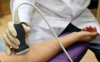 От чего могут болеть сухожилия