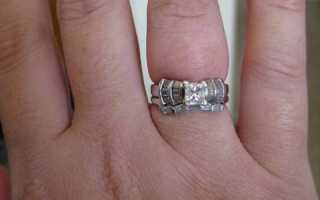 Почему отекают ноги, руки и лицо и что с этим делать