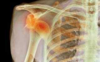 Плечевой пояс