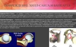 Мрт плечевого сустава