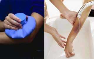 Появление синяков и гематом на руках без причины