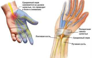 Причины онемения пальцев рук