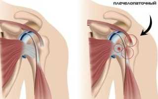 Узнаем все причины боли одновременно в шее и плечах
