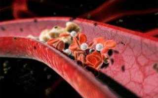 Какие упражнения помогают тем, у кого немеют пальцы рук