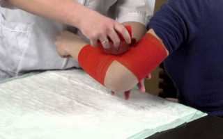 Показания к наложению эластичного бинта на запястье, его действие и виды бинтования