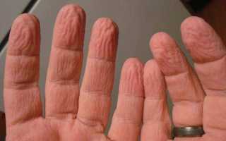 Почему кожа морщится, если долго находиться в воде?